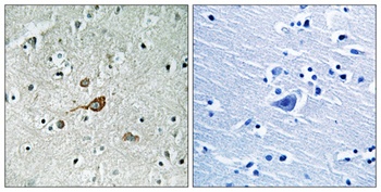 Abl1/2 rabbit pAb