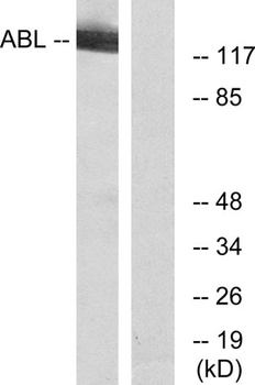 Abl1/2 antibody