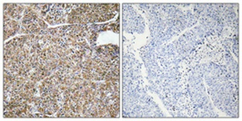 ACBP rabbit pAb