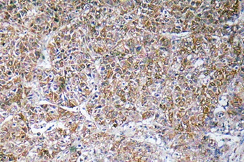 ACBP rabbit pAb