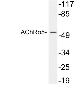 AChR alpha 5 antibody