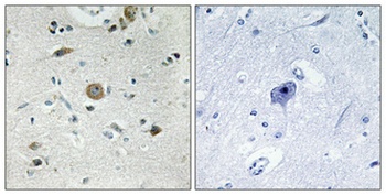 ACOT4 rabbit pAb