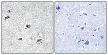 ACSL6 rabbit pAb