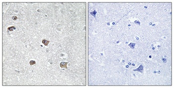 ACSL6 antibody