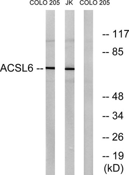 ACSL6 rabbit pAb