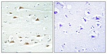 Actinin-alpha1/2/3/4 antibody