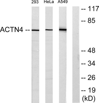 Actinin-alpha1/2/3/4 antibody