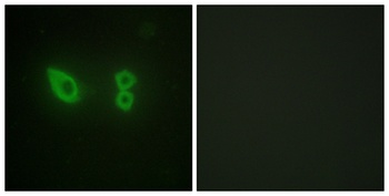 Actinin-alpha2/3 antibody