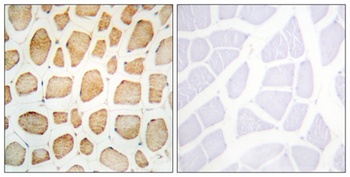 Actinin-alpha2/3 antibody