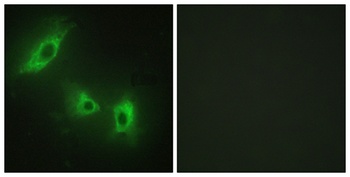 ACTR-IB antibody