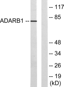 ADAR2 rabbit pAb
