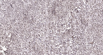 ADAR2 antibody