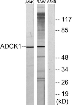 ADCK1 rabbit pAb