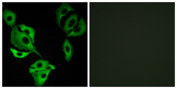 ADCK4 antibody