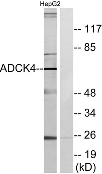 ADCK4 antibody