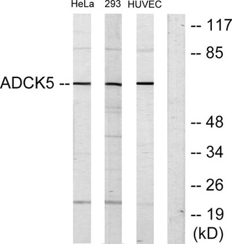 ADCK5 rabbit pAb