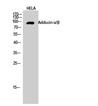 Adducin alpha/beta antibody