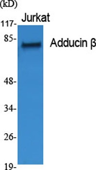 Adducin β rabbit pAb Antibody