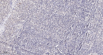 Adducin γ rabbit pAb