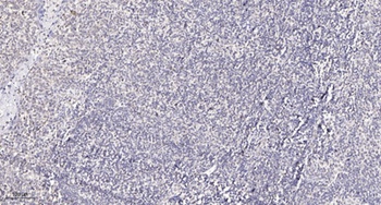 Adducin gamma antibody