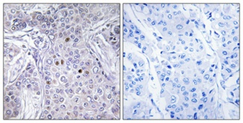 AF-10 antibody