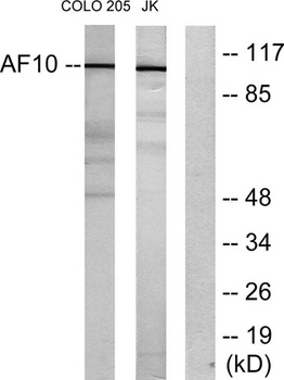 AF-10 antibody