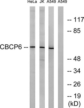 AGBL4 rabbit pAb Antibody