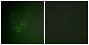 Ah Receptor rabbit pAb