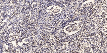 AIF-M1 antibody