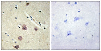 AK5 antibody