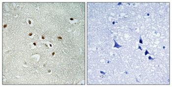 AK6 antibody