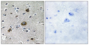 AKAP 149 rabbit pAb