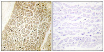 AKAP 95 antibody