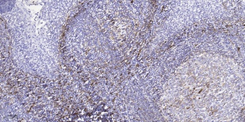 AKR1CL2 rabbit pAb