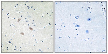 Akt2 rabbit pAb