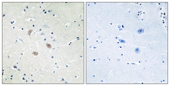 Akt2 antibody