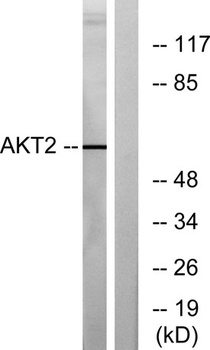 Akt2 rabbit pAb