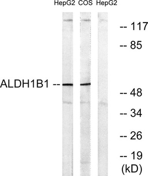 ALDH1B1 rabbit pAb