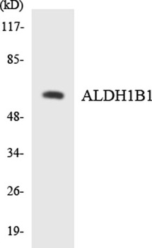 ALDH1B1 rabbit pAb