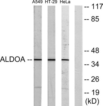 Aldolase A antibody