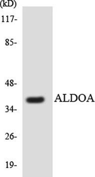 Aldolase A antibody