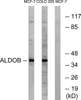 Aldolase B antibody