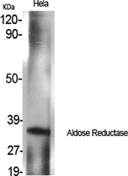 Aldose Reductase antibody