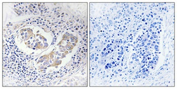 Aldose Reductase antibody