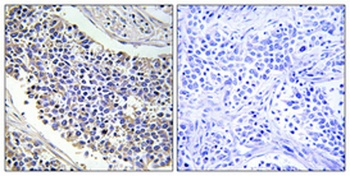 Aldose Reductase rabbit pAb
