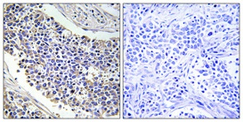 Aldose Reductase antibody