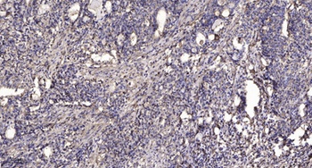 ALMS1 antibody