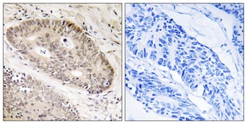 ALS2CR8 antibody