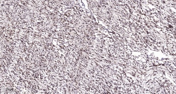 ALX3 antibody