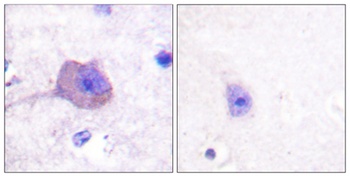 AMPKβ1 rabbit pAb